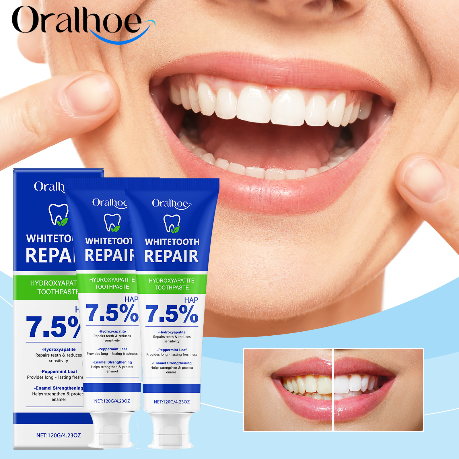 Teeth Whitening Best - Oralhoe Nicotinamide Whitening Toothpaste Mint Plaque