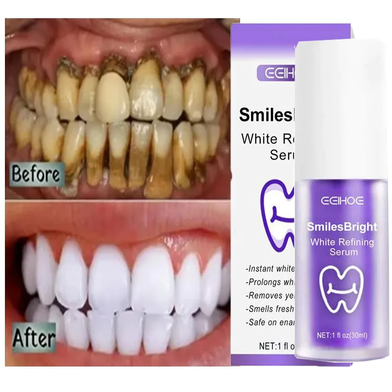 Teeth Whitening In Korea - Whitening Toothpaste Teeth Cleansing Whiten Gel