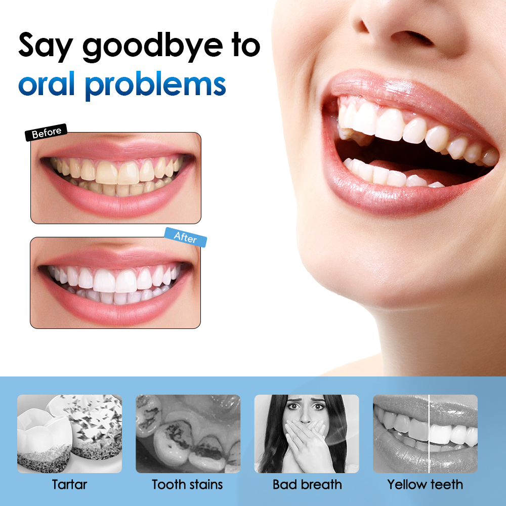 Electric Tooth Cleaner Waterpr - Electric Toothbrush Sonic ulasan dan harga
