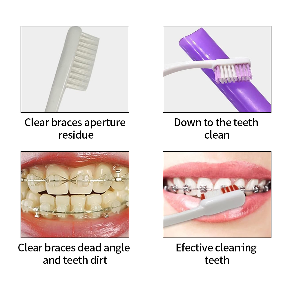 8Pcs/set Orthodontic Dental Ca - Teeth Whitening Brush ulasan dan harga