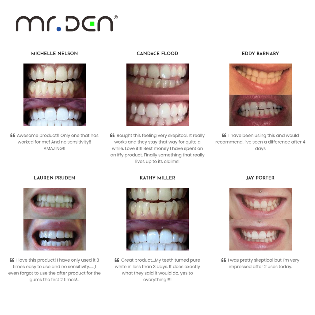 Dr. Whiten 3 Pack Teeth Whiten - Teeth Whitening Light ulasan dan harga