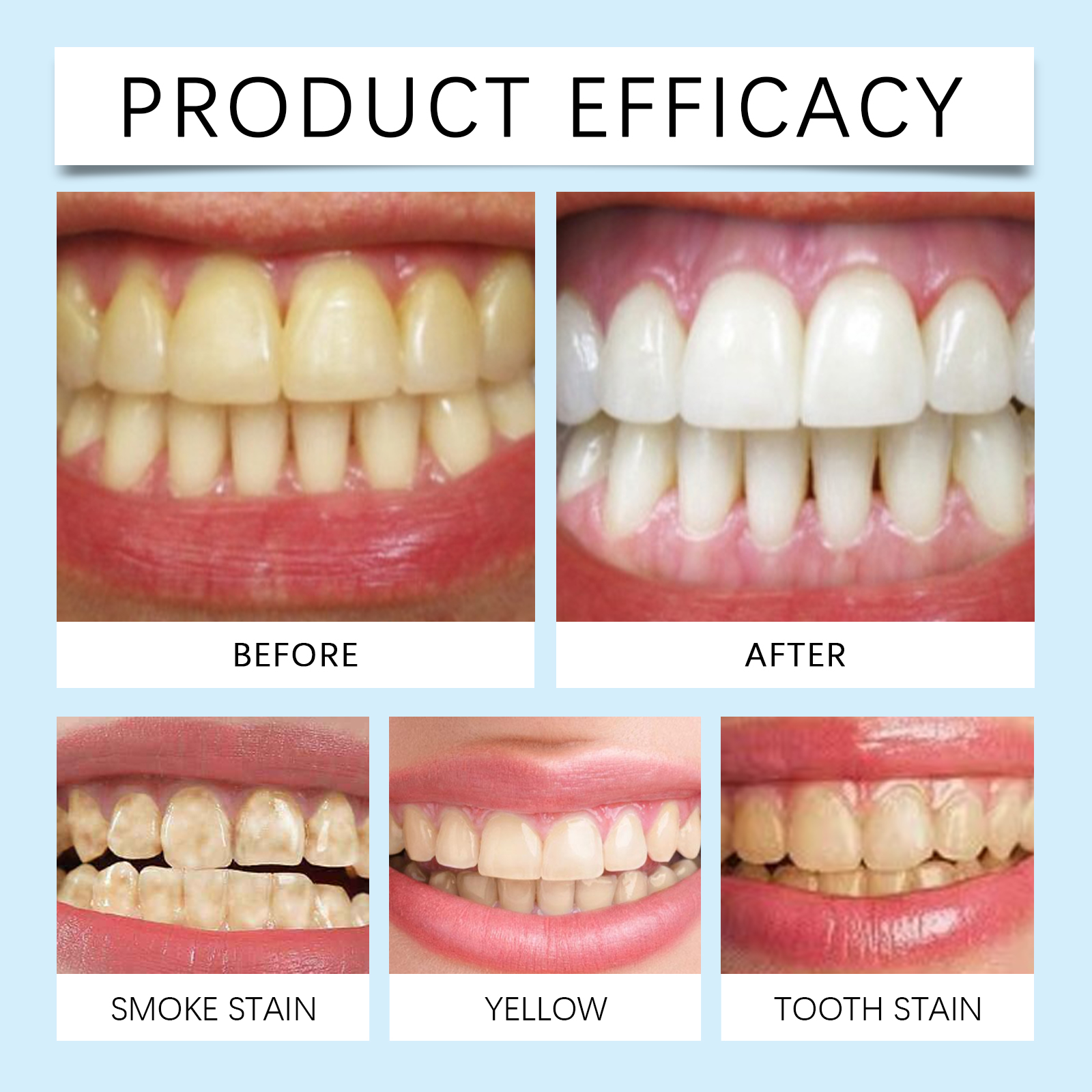 Oralhoe Nicotinamide Whitening - Teeth Whitening Best ulasan dan harga