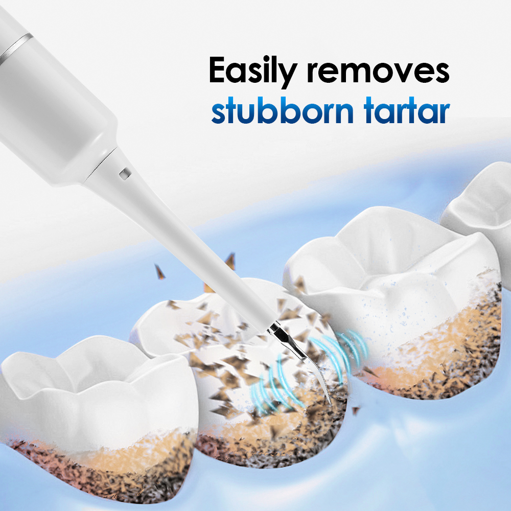 Electric Tooth Cleaner Waterpr - Electric Toothbrush Sonic ulasan dan harga