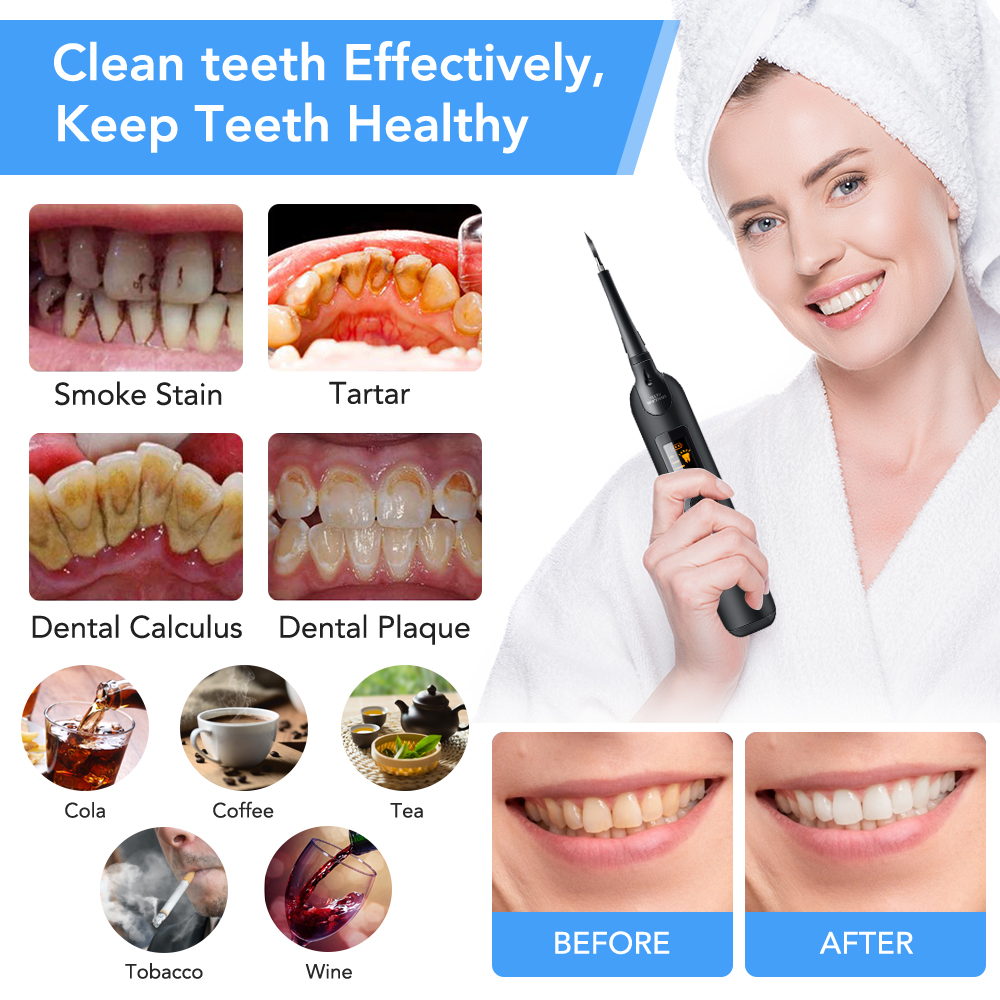 Teeth Tartar Remover Electric  - Teeth Whitening Light Kit ulasan dan harga
