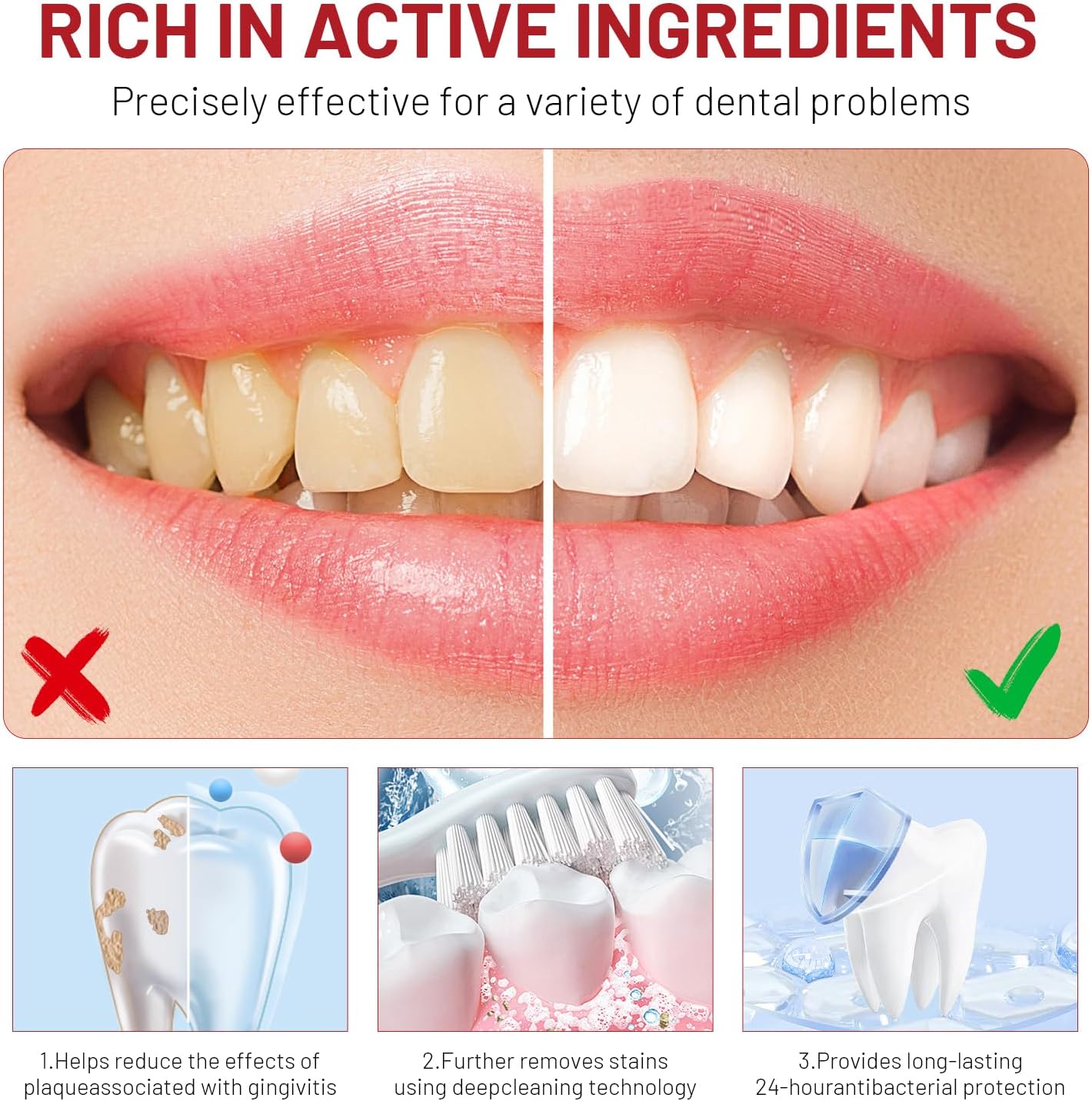 Niacinamide Whitening Toothpas - Teeth Whitening Best ulasan dan harga