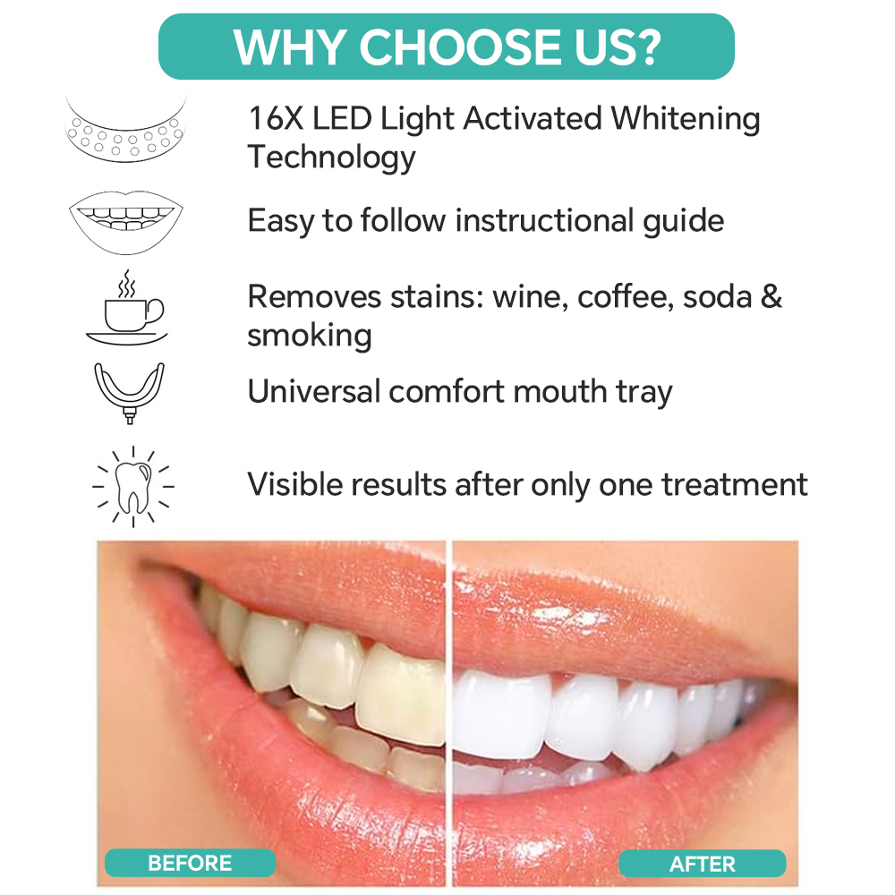 Teeth Whitening Accelerator Li - Teeth Whitening Accelerator ulasan dan harga