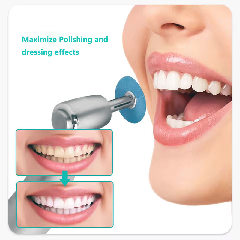 40pcs Dental Polishing Discs H - Teeth Whitening Home ulasan dan harga