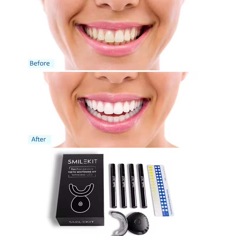 Wholesale Approved Private log - Teeth Whitening Uv ulasan dan harga