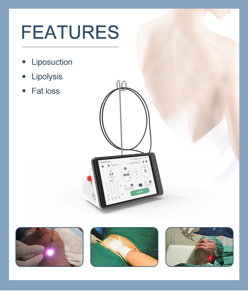 Dental Laser Teeth Whitening D - Teeth Whitening With Laser ulasan dan harga