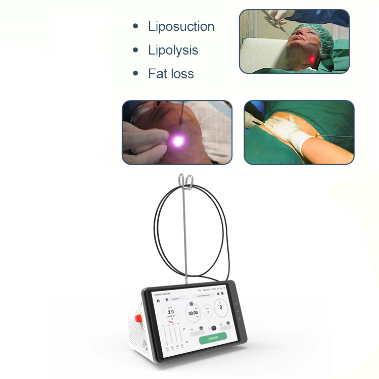 Dental Laser Teeth Whitening D - Teeth Whitening With Laser ulasan dan harga