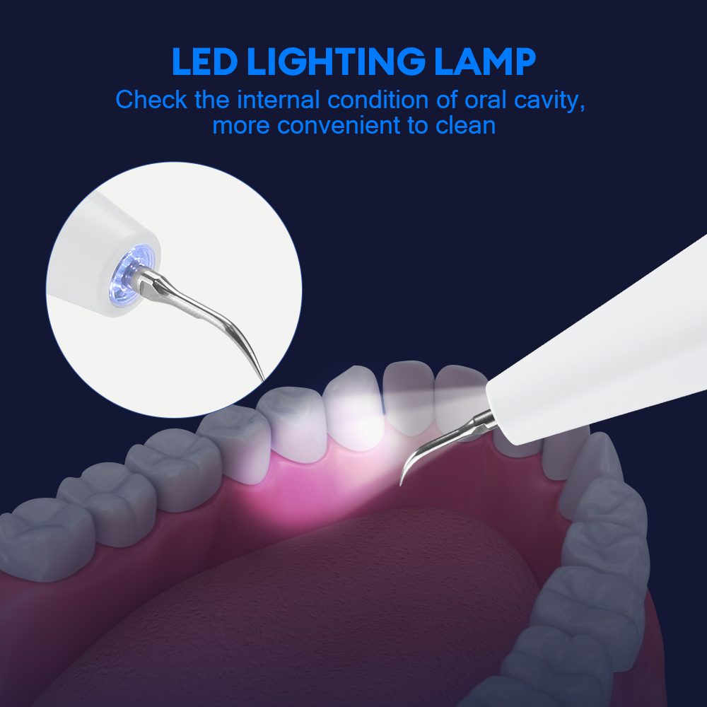 Ultrasonic Dental Calculus Rem - Teeth Whitening Home ulasan dan harga