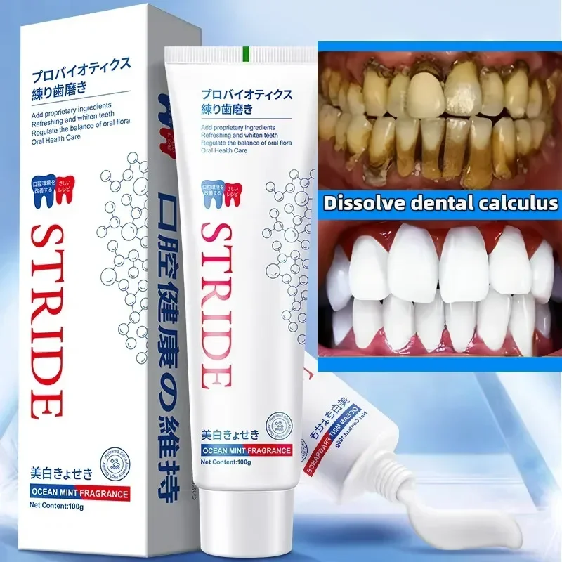 Dental Calculus Remover Remova - Teeth Whitening Best ulasan dan harga