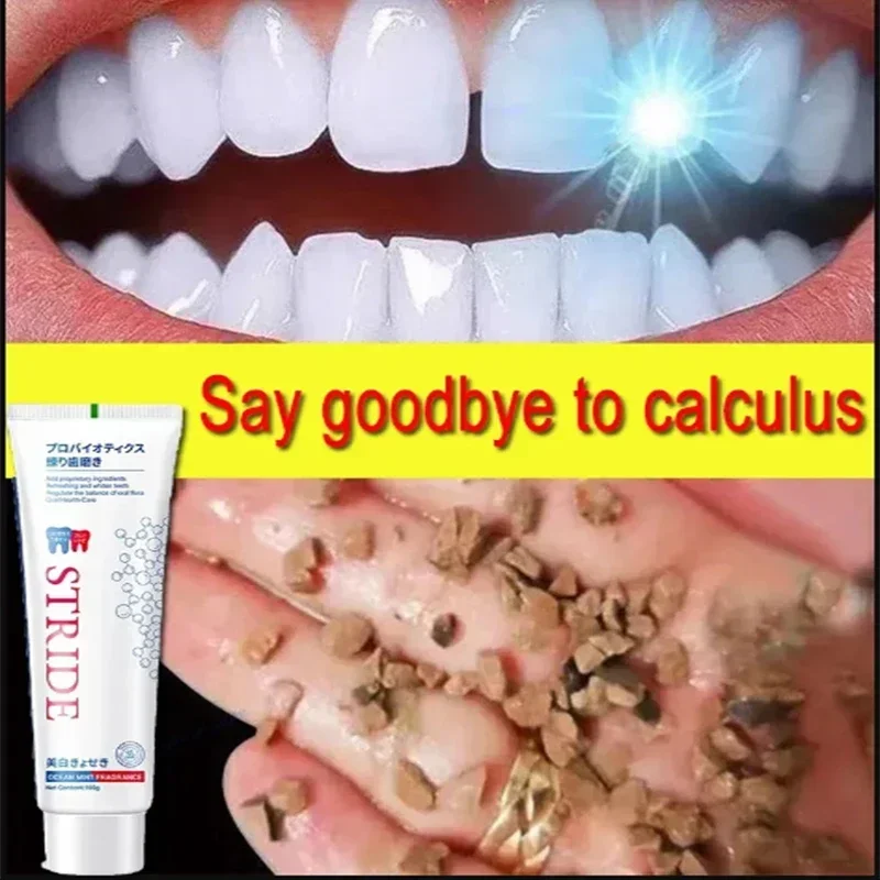Dental Calculus Remover Remova - Teeth Whitening Best ulasan dan harga