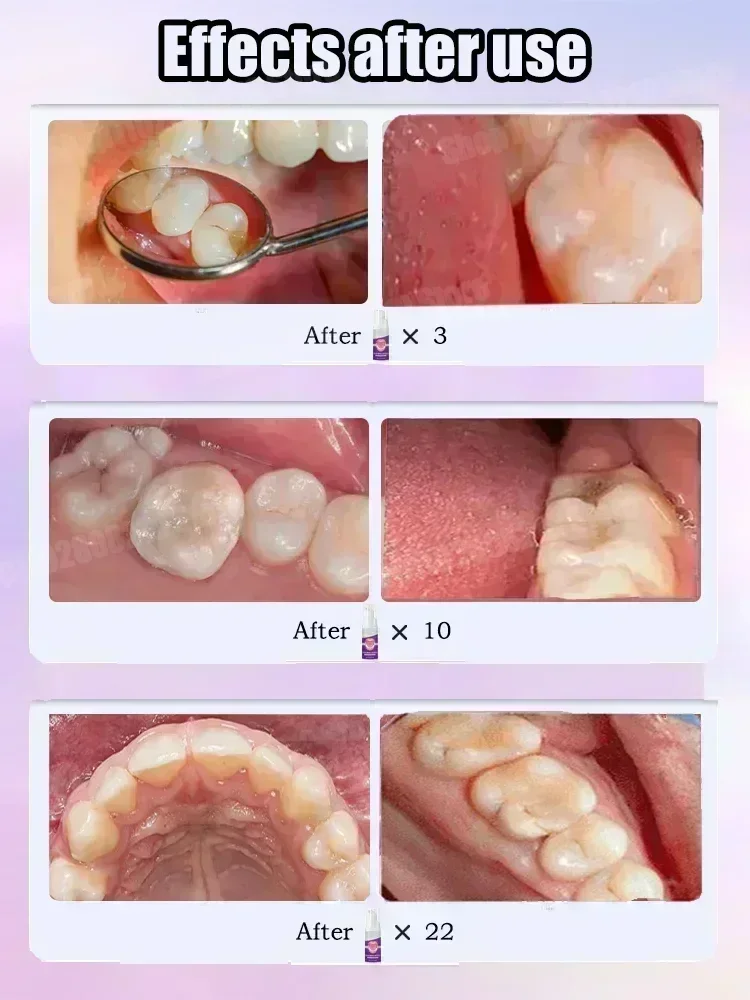 Hot sales Best-selling, Scient - Teeth Whitening Best ulasan dan harga