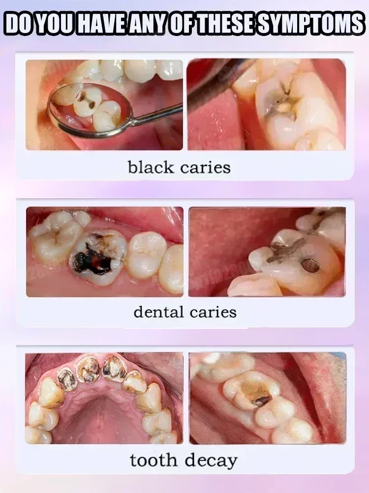 Hot sales Best-selling, Scient - Teeth Whitening Best ulasan dan harga