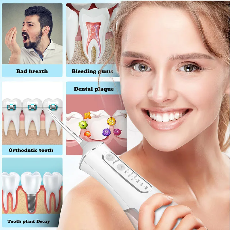 Portable Dental Water Irrigato - Teeth Whitening With Laser ulasan dan harga