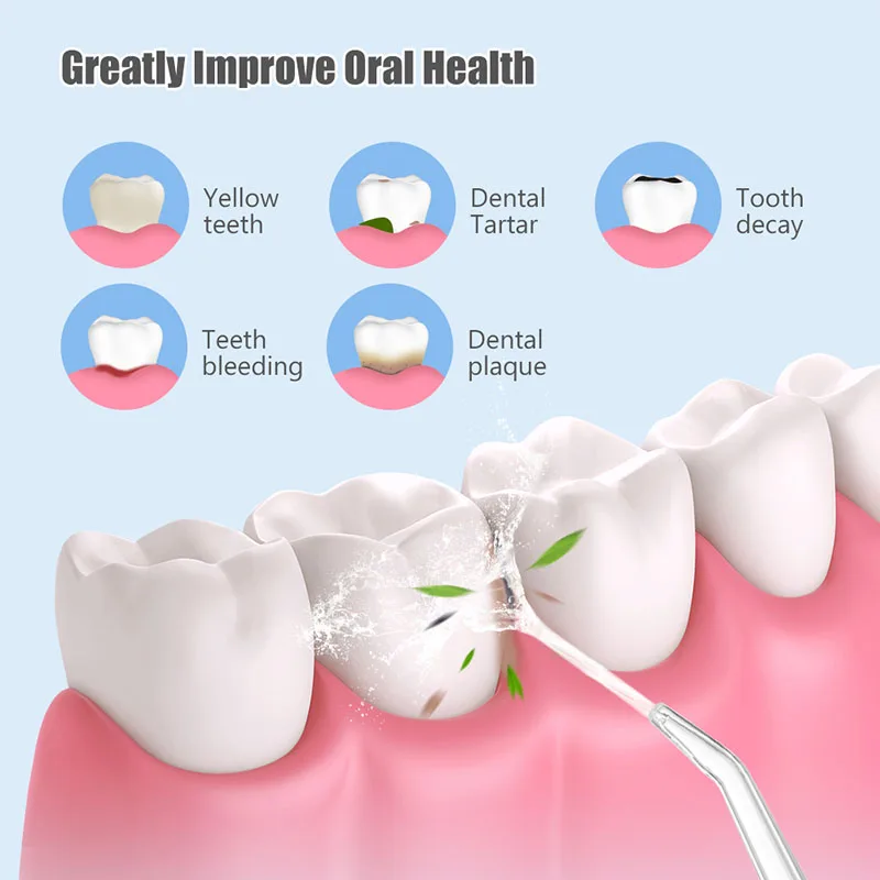 Portable Dental Water Irrigato - Teeth Whitening With Laser ulasan dan harga