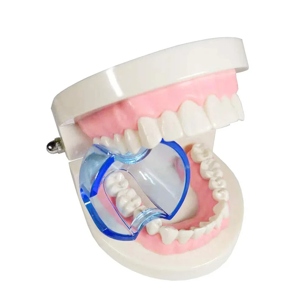 Dental Intraoral Cheek Retract - Teeth Whitening Accelerator ulasan dan harga