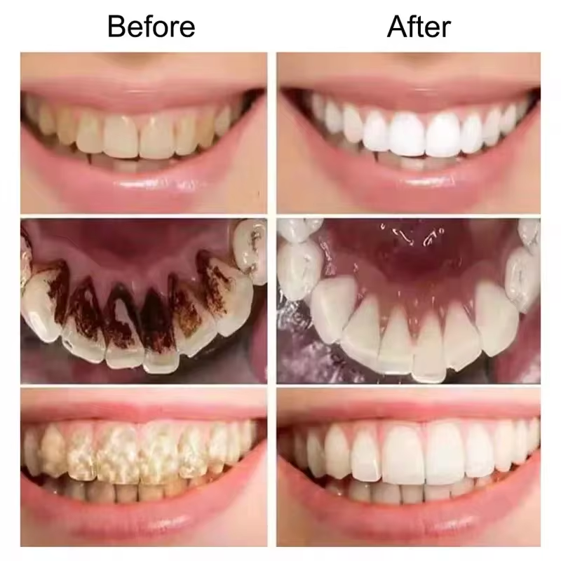 7.5% Hydroxyapatite Probiotic  - Teeth Whitening Best ulasan dan harga