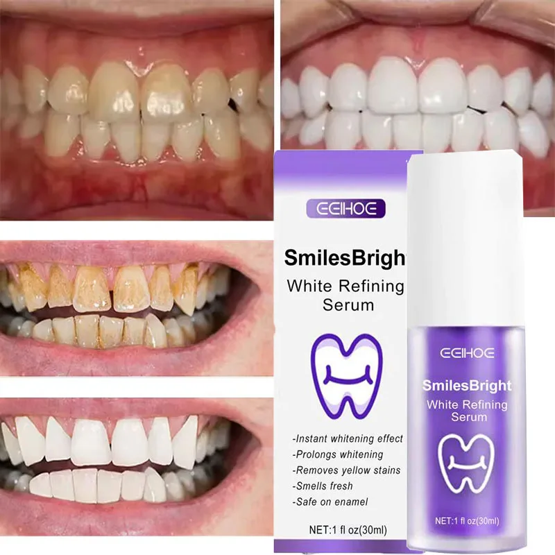 Whitening Toothpaste Teeth Cle - Teeth Whitening In Korea ulasan dan harga