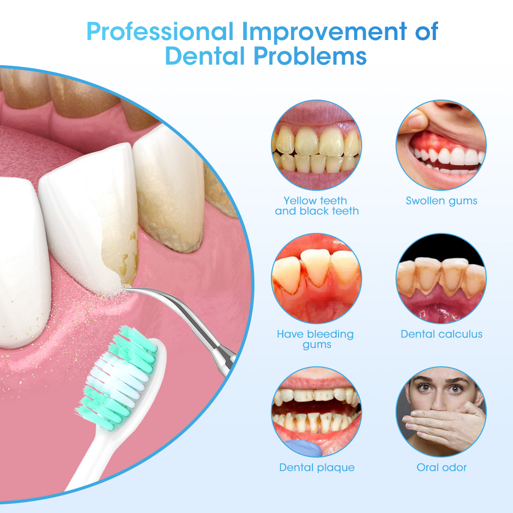 Electric Teeth Cleaner Sonic D - Electric Toothbrush Sonic ulasan dan harga