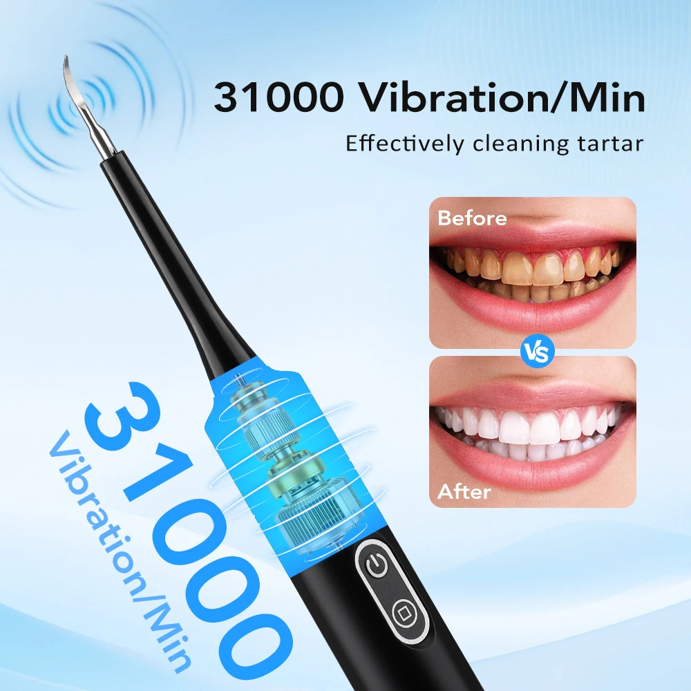Electric Sonic Vibration Denta - Electric Toothbrush Sonic ulasan dan harga